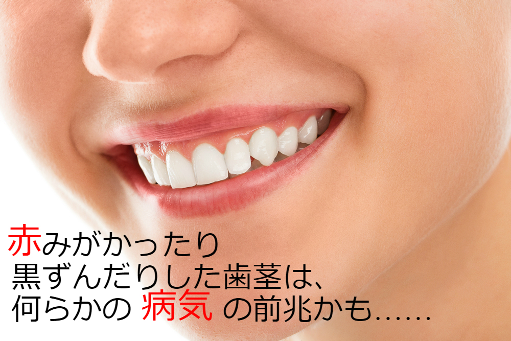 健康な歯茎の特徴とは？歯周病予防でピンク色を維持しよう 歯周病治療なら東京国際クリニック/歯科