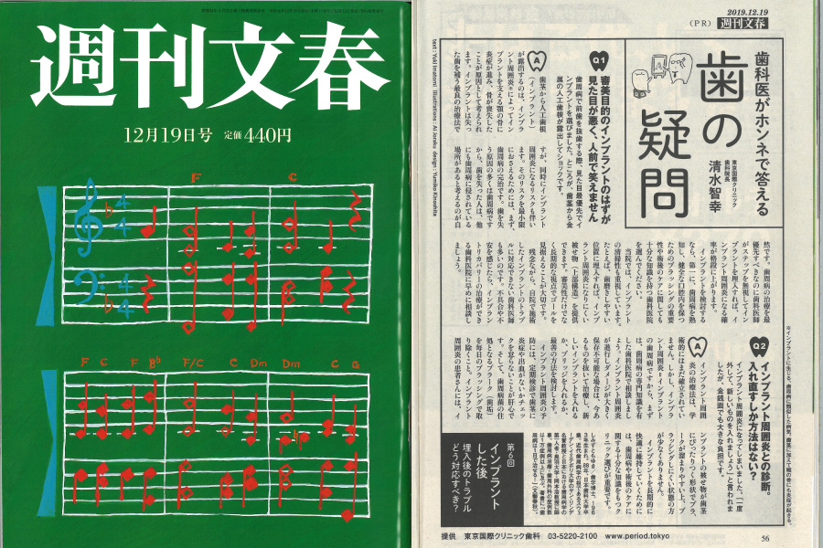 週刊文春」12月19日号に連載6回企画【歯科医がホンネで答える「歯の疑問」】の第6回目の記事が掲載されました。 |  歯周病治療なら東京国際クリニック/歯科