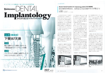 「Quintessence DENTAL Implantology」に寄稿しました。