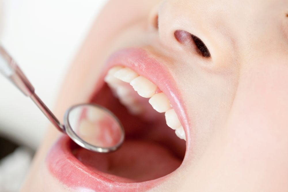 「歯肉炎」と「歯周病」って何が違うの？