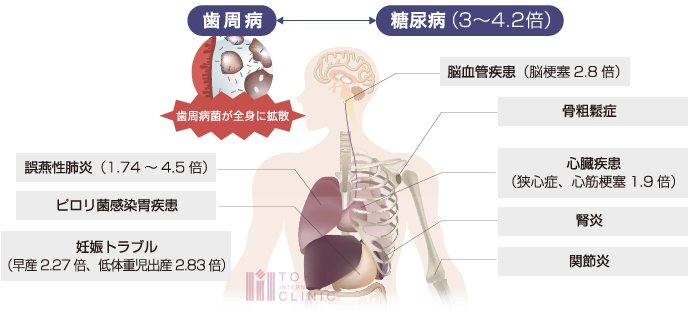 歯科ドックでは全身疾患のリスクを探ることもできます